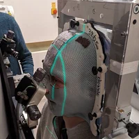 MRI-based proton therapy dose planning for eye tumour